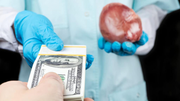 Казахстанец пытался продать свой орган за 15 млн тенге